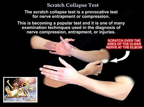 scratch test carpal tunnel|long thoracic nerve injury test.